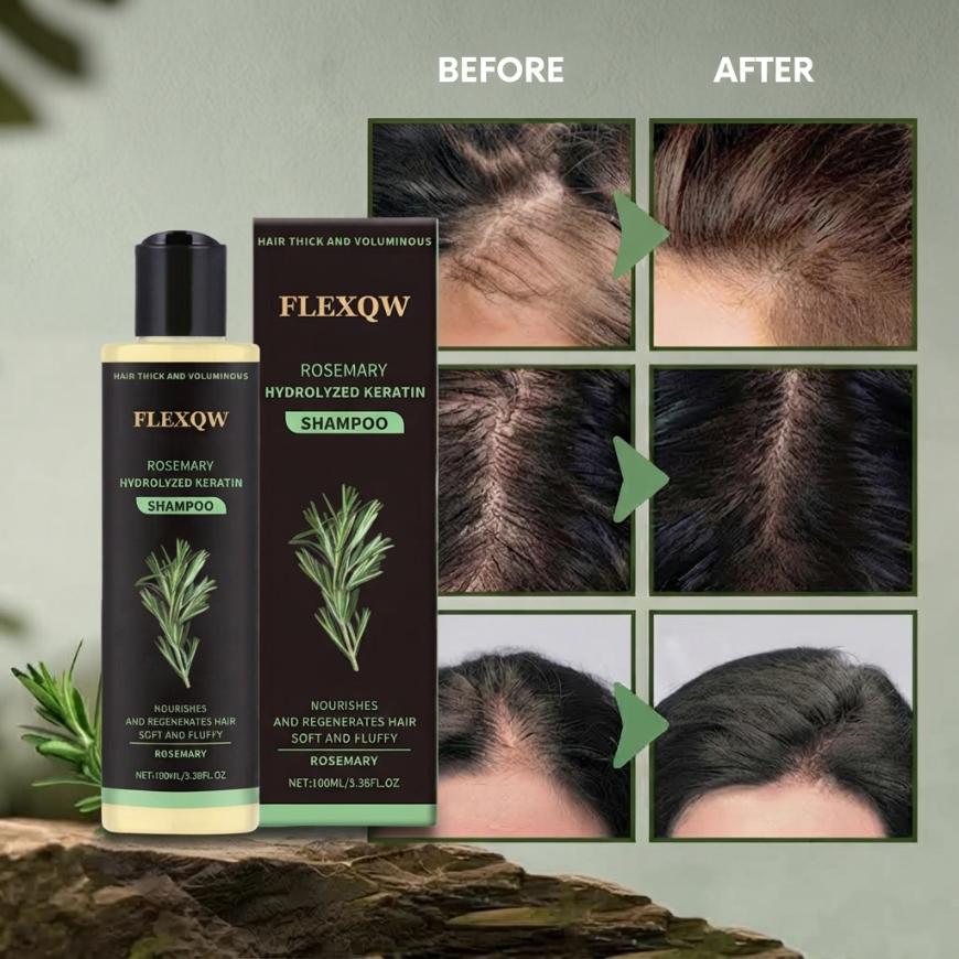 FlexQW | Thicker, Fuller Hair In Just 2 Weeks!