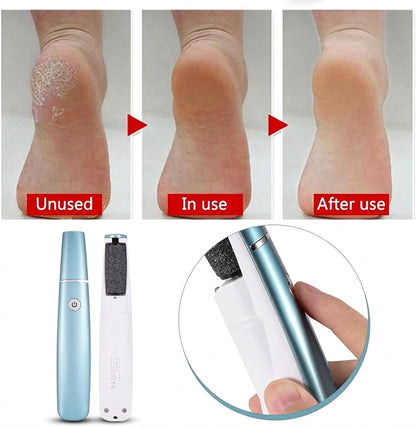 SilkPro | Electric Callus Remover | Silky Smooth Feet in Minutes