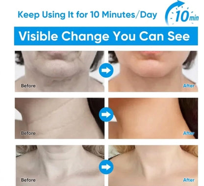 V-Face Therapy™ I Enjoy Instantly Smoother, Fresher & Tighter Skin