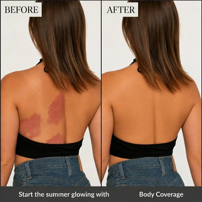 Wudaskin | Body Coverage Concealer + Free Brush
