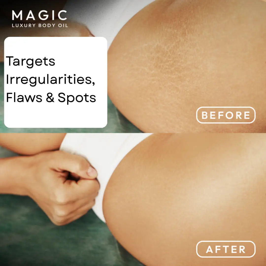 Magic Body Oil - 100ml | Plumps, Tightens, Firms & Hydrates Skin