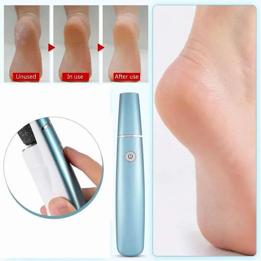 SilkPro | Electric Callus Remover | Silky Smooth Feet in Minutes