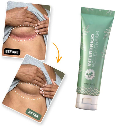 Intertrigo | Stop Burning, Itching & Wetness of Skin Fold Rash In 60 Seconds