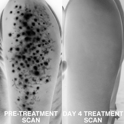 Strawberry | Reduce Redness, Inflammation & Bumps In 4 Days