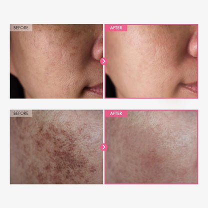 Dan-Bi | Korean Advanced Arbutin Brightening Cream