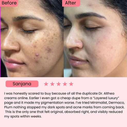 345 Relief Cream | Calms Redness, Fades Spots, & Repairs Your Barrier.