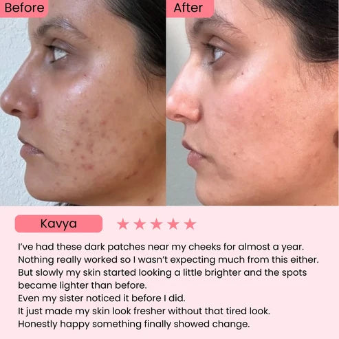 345 Relief Cream | Calms Redness, Fades Spots, & Repairs Your Barrier.
