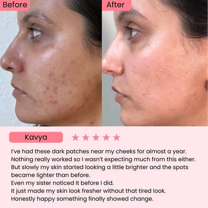 345 Relief Cream | Calms Redness, Fades Spots, & Repairs Your Barrier.