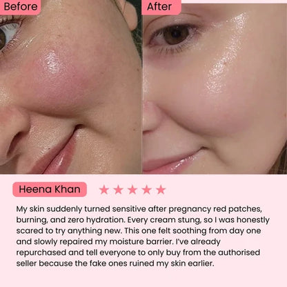 345 Relief Cream | Calms Redness, Fades Spots, & Repairs Your Barrier.