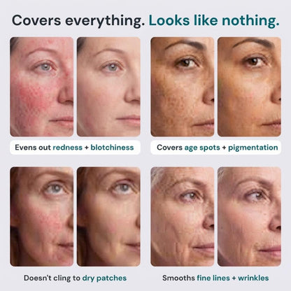 SooAura | Look Up to 10 Years Younger
