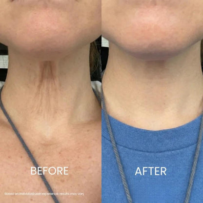Zyrenol® | Tightening & Lifting Neck Cream