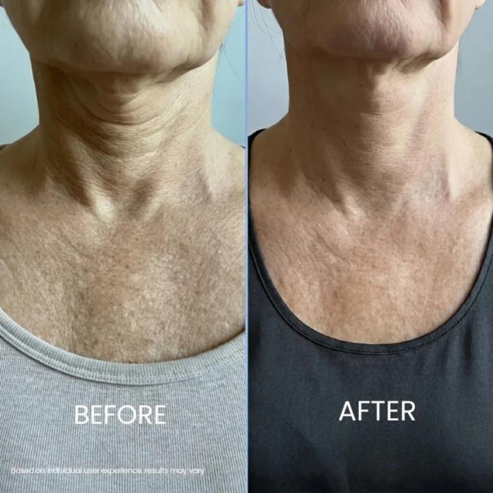 Zyrenol® | Tightening & Lifting Neck Cream