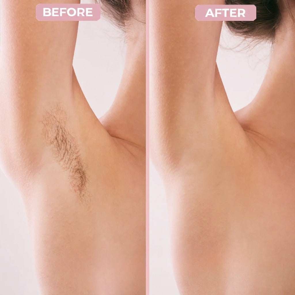 Fendy™ - 2-in-1 All Body Razor for Women