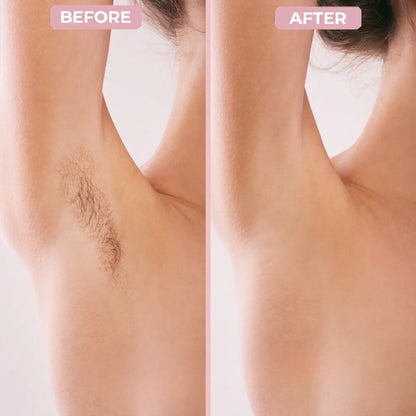 Fendy™ - 2-in-1 All Body Razor for Women