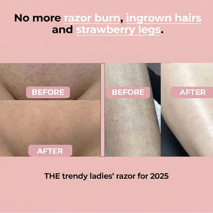 Fendy™ - 2-in-1 All Body Razor for Women
