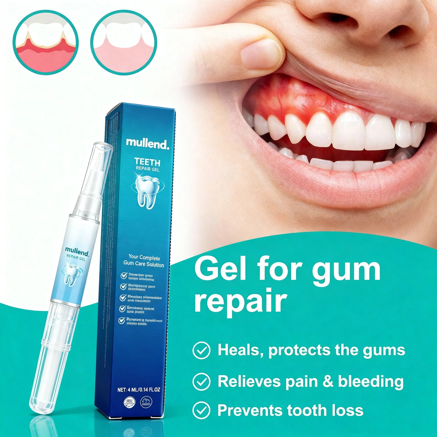 Gum-Protect | Revitalizes Gums & Whitens Teeth Within The First Week